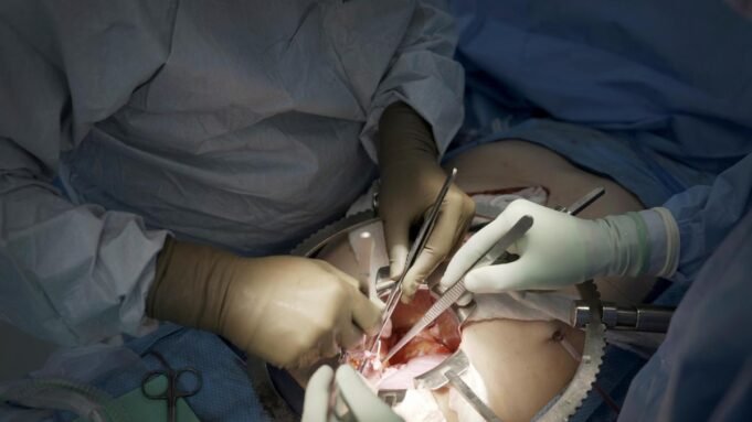 Ξεκινά η πρώτη κλινική δοκιμή μεταμοσχεύσεων νεφρού χοίρου | presscode.gr Google Preferred Source