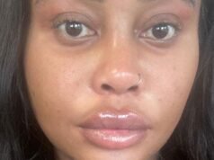 Ξόδεψα 50.000 £ σε ένα LIFT ΠΡΟΣΩΠΟΥ πριν από τα τριάντα μου γενέθλια – οι άνθρωποι νομίζουν ότι είμαι τρελός, αλλά άξιζε κάθε δεκάρα
| presscode.gr Ξόδεψα 50.000 £ σε ένα LIFT ΠΡΟΣΩΠΟΥ πριν από τα τριάντα μου γενέθλια - οι άνθρωποι νομίζουν ότι είμαι τρελός, αλλά άξιζε κάθε δεκάρα
| presscode.gr