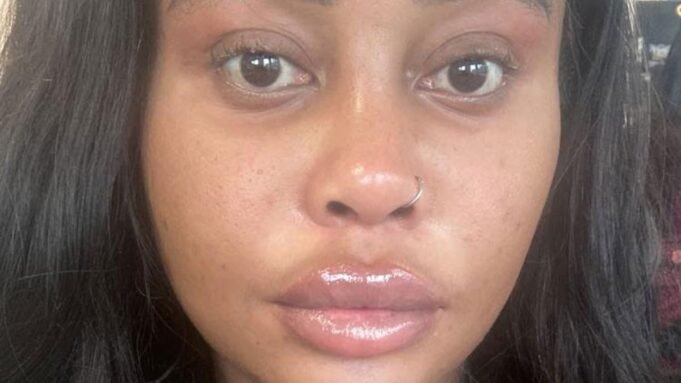 Ξόδεψα 50.000 £ σε ένα LIFT ΠΡΟΣΩΠΟΥ πριν από τα Ξόδεψα 50.000 £ σε ένα LIFT ΠΡΟΣΩΠΟΥ πριν από τα τριάντα μου γενέθλια - οι άνθρωποι νομίζουν ότι είμαι τρελός, αλλά άξιζε κάθε δεκάρα
| presscode.gr