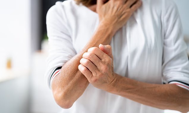 Τα χέρια μου έχουν πάντα φαγούρα και με τρελαίνει. Ποια Τα χέρια μου έχουν πάντα φαγούρα και με τρελαίνει. Ποια θα μπορούσε να είναι η αιτία; Θα μπορούσε να είναι μια ανησυχητική λοίμωξη, λέει ο DR PHILIPPA KAYE - αλλά υπάρχει θεραπεία
| presscode.gr