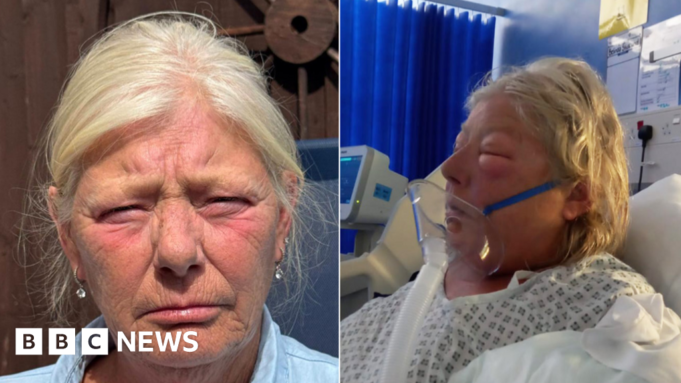 Η Γκραν γρονθοκόπησε από έγκυο εισβολέα στην κηδεία αηδιασμένη με Η Γκραν γρονθοκόπησε από έγκυο εισβολέα στην κηδεία αηδιασμένη με την ποινή
| presscode.gr